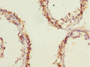 Anti-ERMP1 Antibody