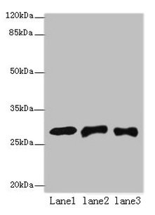 Anti-ETHE1 Antibody