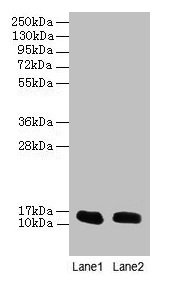 Anti-FABP1 Antibody