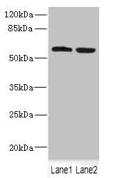 Anti-FTCD Antibody