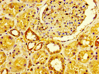 Anti-LRP2 Antibody