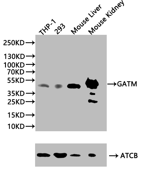 Anti-GATM Antibody