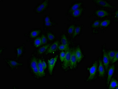 Anti-GLIPR1 Antibody