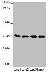 Anti-GNB2 Antibody