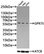 Anti-GPR75 Antibody