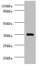 Anti-PPP2CB Antibody