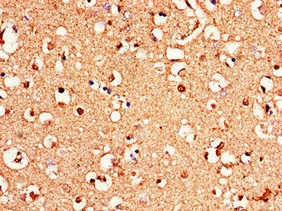 Anti-GRM1 Antibody