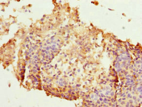 Anti-HEXIM1 Antibody