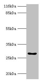 Anti-HOXA6 Antibody