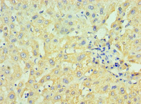 Anti-HSD17B4 Antibody