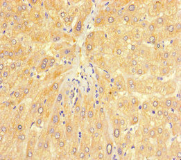 Anti-CHD4 Antibody