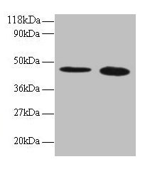 Anti-TTC1 Antibody