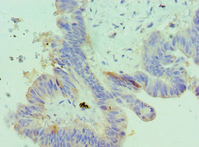 Anti-IGFBP4 Antibody