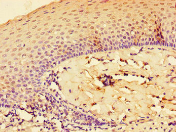 Anti-IL33 Antibody