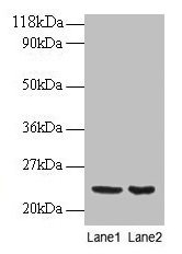 Anti-PRDX1 Antibody
