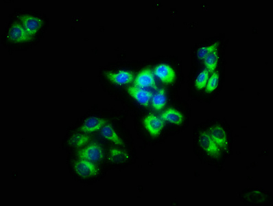 Anti-IMPG2 Antibody