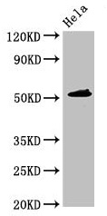 Anti-IP6K1 Antibody