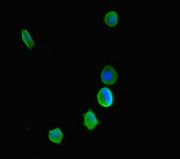 Anti-KDM5C Antibody