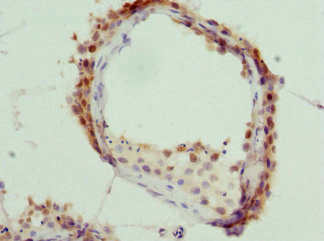 Anti-KHDRBS3 Antibody