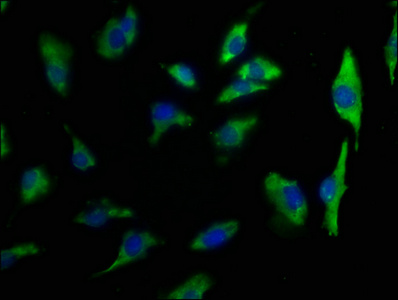 Anti-TMEM131L Antibody