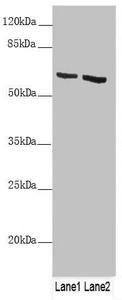 Anti-KRT6B Antibody