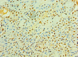 Anti-LIMK2 Antibody