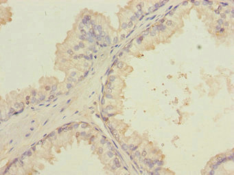 Anti-LMO4 Antibody