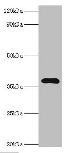 Anti-LRG1 Antibody