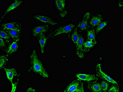 Anti-MAP1LC3B2 Antibody