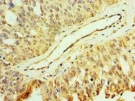 Anti-MAP2K3 Antibody