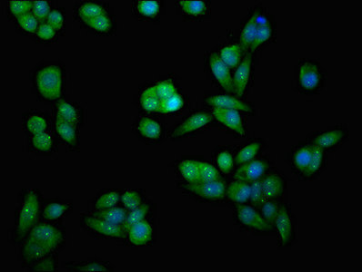 Anti-MAP2K7 Antibody