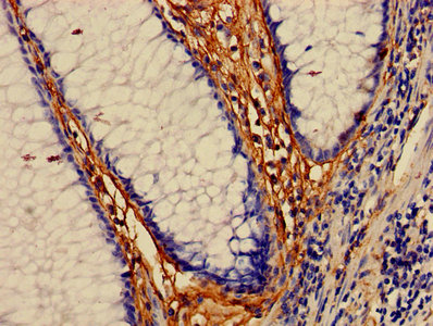 Anti-MAP3K7 Antibody