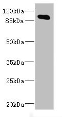 Anti-MAP4K5 Antibody