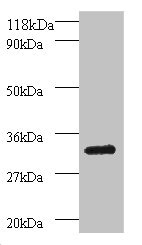 Anti-PSMB7 Antibody