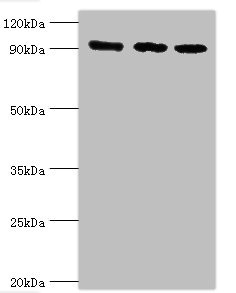 Anti-MCM3 Antibody