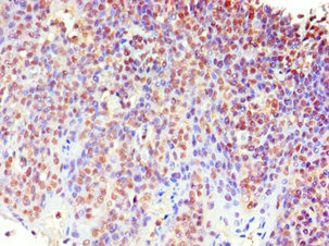 Anti-MECP2 Antibody