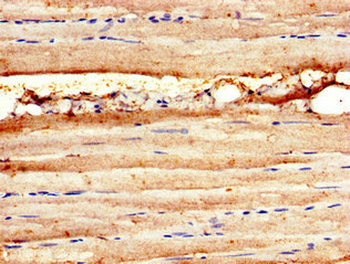 Anti-MAP3K11 Antibody