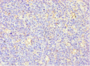 Anti-MSLN Antibody