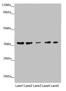 Anti-MTHFD2 Antibody