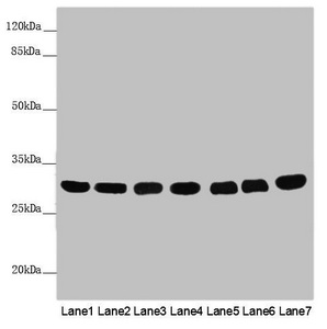Anti-MTX2 Antibody