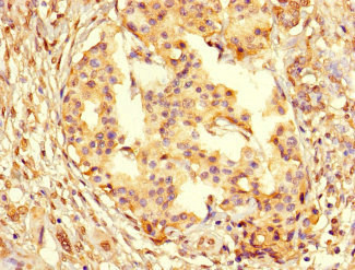 Anti-PCNA Antibody