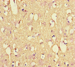 Anti-NEFL Antibody