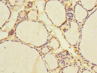 Anti-NFKBIE Antibody