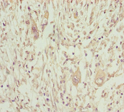 Anti-NPTN Antibody