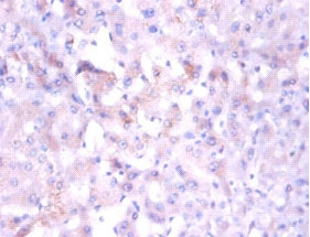 Anti-NDUFA1 Antibody