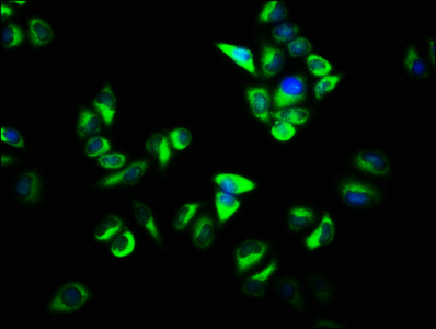 Anti-OSBP Antibody