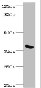 Anti-PHYH Antibody