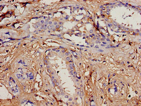 Anti-PIP Antibody