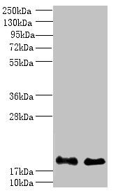 Anti-PPP3R1 Antibody