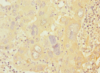 Anti-PRKAR1B Antibody